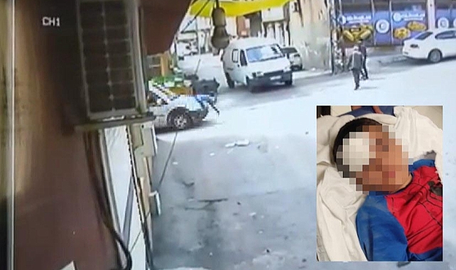 Kardeşini Kurtarmak İsterken Kendisini Yaraladı