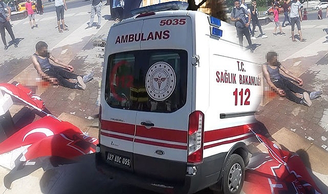 Kendini sokak ortasında yaktı!