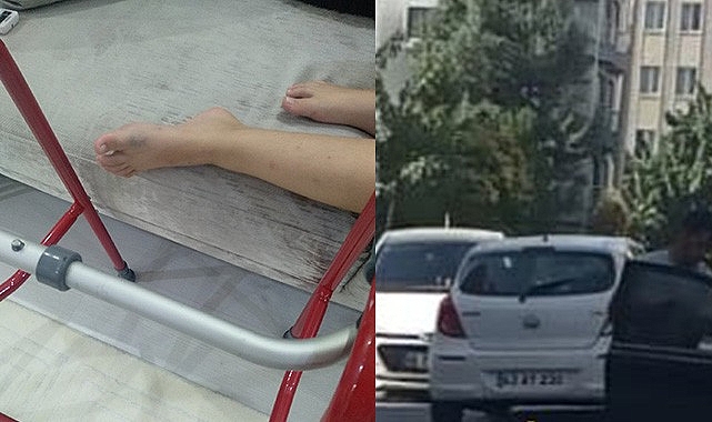 Önce çarptı sonra arkasına bakmadan kaçtı!