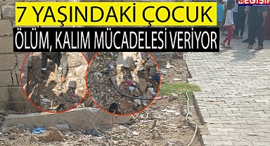 Şanlıurfa'da 7 yaşındaki çocuğa elektrik çarptı!