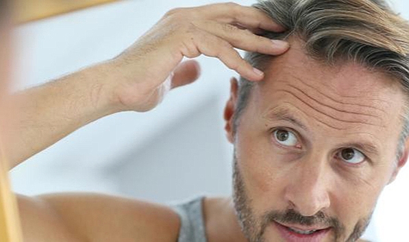 Demir ve vitamin eksikliği kelliğe yol açıyor