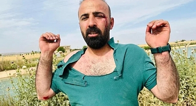 HDP Şanlıurfa İl Başkanı ve avukatlar saldırıya uğradı!