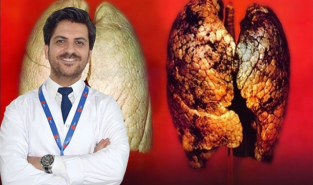 Akciğer kanserine dikkat! Uzman uyardı