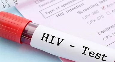 Prof. Dr. Haluk Erdoğan: "2010'dan bu yana HIV ile yaşayan birey sayısı 9 kat arttı"