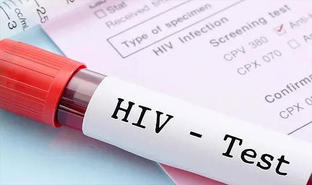 Prof. Dr. Haluk Erdoğan: "2010'dan bu yana HIV ile yaşayan birey sayısı 9 kat arttı"