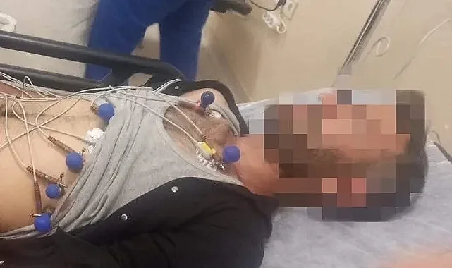Suruç'ta bir vatandaşı tuvalette yılan ısırdı