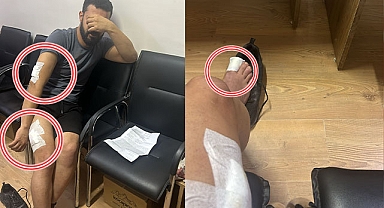 Suruç'ta haciz işlemi için aynı iş yerine giden 2. avukat da saldırıya uğradı