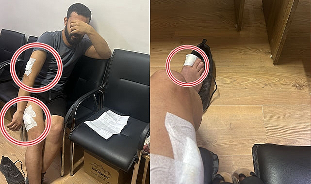 Suruç'ta haciz işlemi için aynı iş yerine giden 2. avukat da saldırıya uğradı