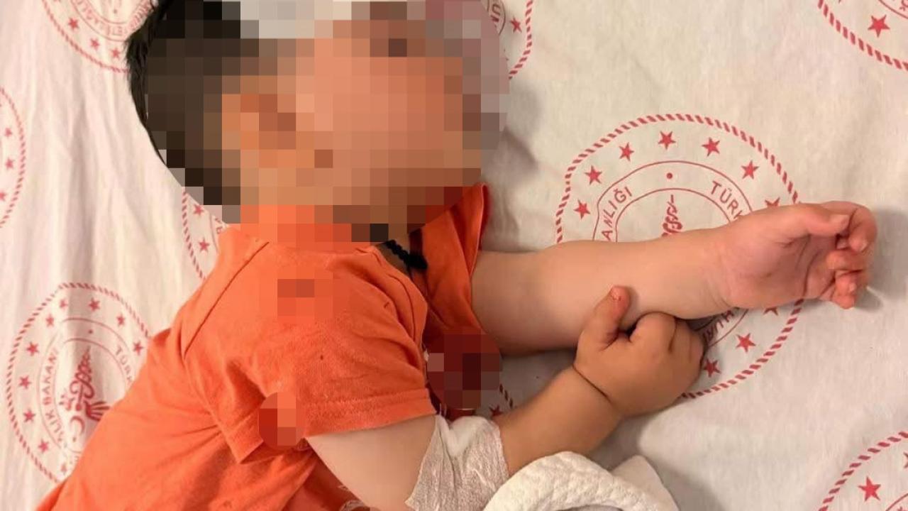 1,5 Yaşındaki Çocuğa Köpek Saldırdı